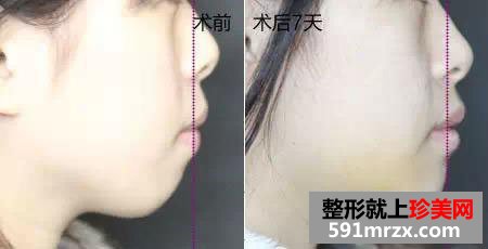 服装,设计师,隆下巴,淘女郎