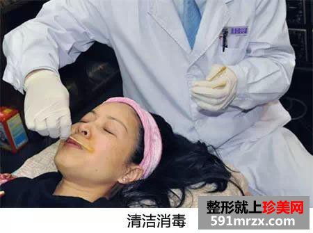 自体活细胞,面部,年轻化