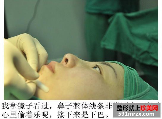 广州,博仕,五官,整形,全过程