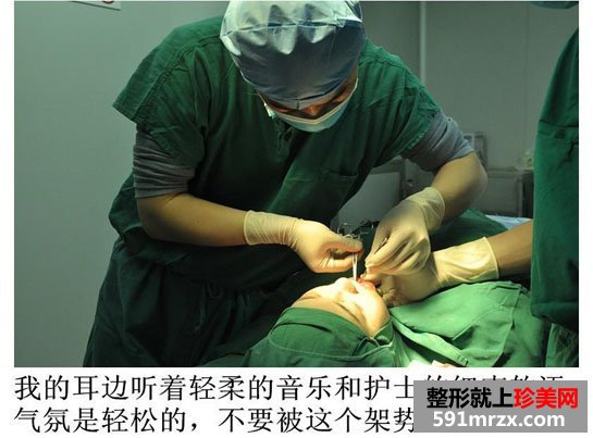 广州,博仕,五官,整形,全过程