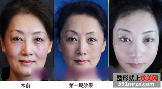 广州,海峡,整形,医院,女王,计划