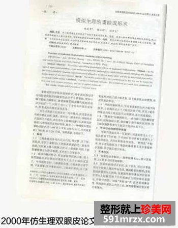 上海,宏康,整形,医院,仿生理,双眼皮