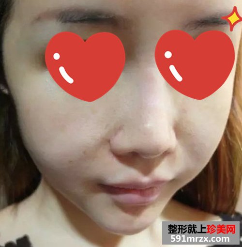 上海,时光,整形,医院,音波,拉皮,非手术,紧肤,新体验