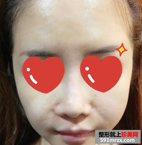 上海,时光,整形,医院,音波,拉皮,非手术,紧肤,新体验