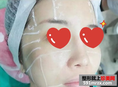 上海,时光,整形,医院,音波,拉皮,非手术,紧肤,新体验