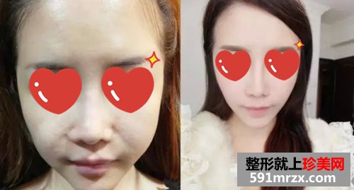 上海,时光,整形,医院,音波,拉皮,非手术,紧肤,新体验