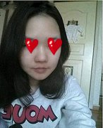 大连微美整形医院韩式misko隆鼻让我拥有秀美挺鼻