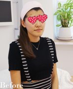 杭州格莱美整形医院美肤神器水光注射美肌又嫩肤