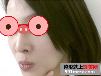 杭州,同欣,整形,美容,医院,瓜子脸