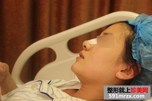宁波,薇琳,整形,医院,韩式misko隆鼻,气质