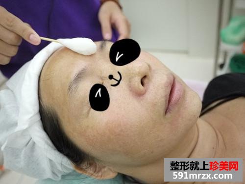 金华,华美,整形,医院,埋线,提拉,10年,青春