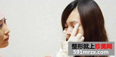 台州,整形,医院,埋线,双眼皮,一单一双