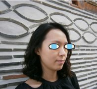 太原华美整形医院隆鼻手术效果太自然了真后悔没有早点做
