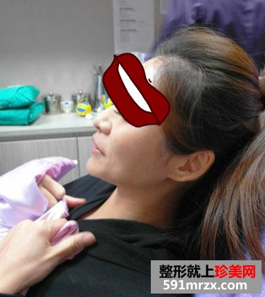 济南,鹏爱,美容,整形,医院,Misko隆鼻,闺蜜,颜值