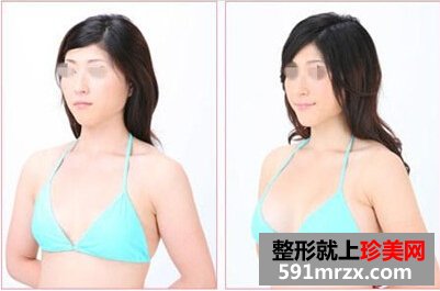 大龄剩女,患癌,失乳,事业线