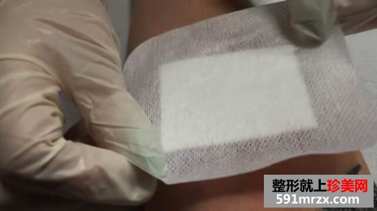 皮秒,激光,洗纹身,效果,妹子,真实,经历