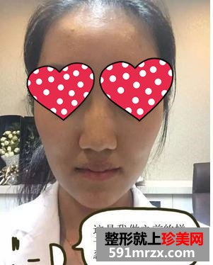 温州,加美,整形,美容,医院,水光注射,素颜,上班