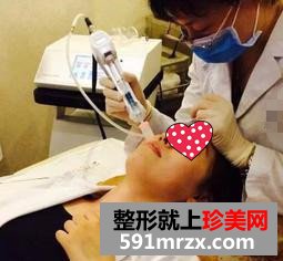 温州,加美,整形,美容,医院,水光注射,素颜,上班