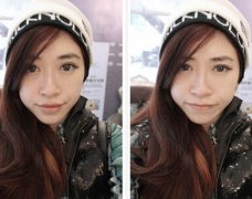 漂亮MM分享打完瘦脸针的皂片美翻了