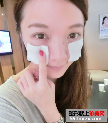开眼角,双眼皮,萌妹纸