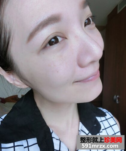 开眼角,双眼皮,萌妹纸