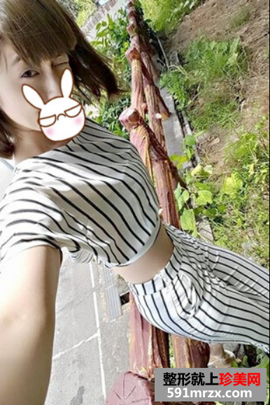 大腿,吸脂,少女,时代,大美腿