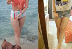 做完大腿吸脂大象腿秒变女神腿，不信你来看
