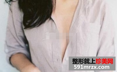 新维度自体脂肪隆胸,北京自体脂肪隆胸术