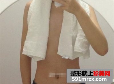 新维度自体脂肪隆胸,北京自体脂肪隆胸术