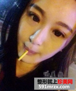 微创双眼皮整形医院