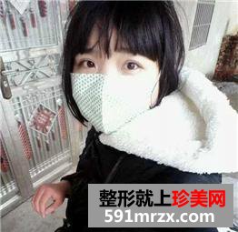 三点式双眼皮