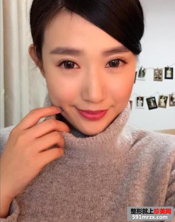北京韩式三点双眼皮