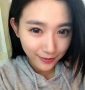 做了韩式三点双眼皮和隆鼻恢复后晒图