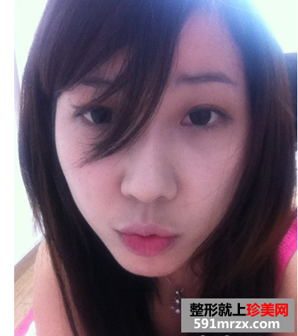 韩式生科隆鼻,溶脂针瘦脸