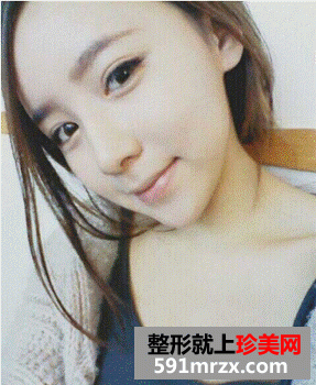 假体隆鼻后效果自然吗