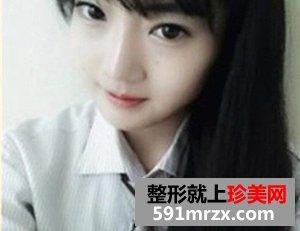 下颌角整形