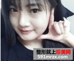 下颌角整形