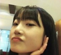 下颌角整形原来我也可以是萌妹子