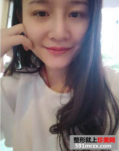 耳软骨隆鼻有后遗症吗