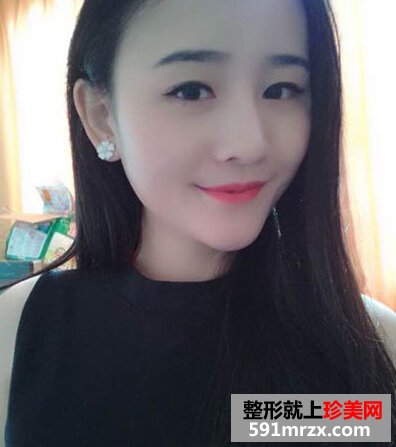 耳软骨隆鼻有后遗症吗
