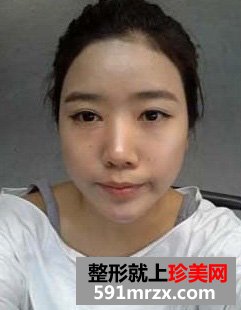 卧蚕眼,卧蚕美女