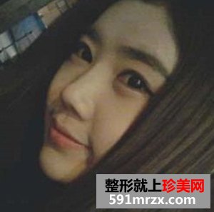 卧蚕眼,卧蚕美女