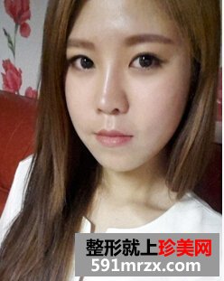 法令纹深怎么办,玻尿酸祛法令纹