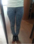 臀部吸脂手术变身超级无敌美少女