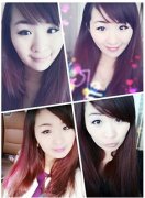 割双眼皮多久能恢复这个得看保养啊