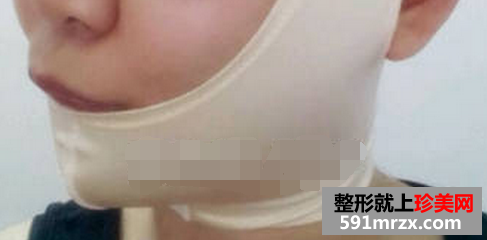 面部吸脂瘦脸+假体垫下巴 重生之女神养成计划