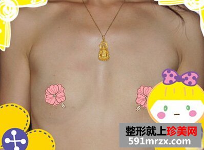es假体隆胸,迷人乳沟