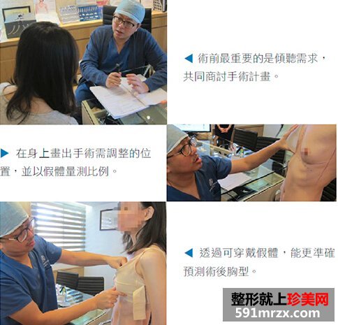 进口假体隆胸,沙滩比基尼美女