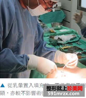 进口假体隆胸,沙滩比基尼美女