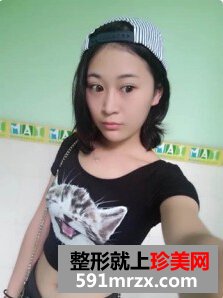 膨体隆鼻后取出假体,打玻尿酸隆鼻子